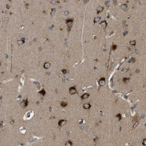 Anti-STARD3NL antibody produced in rabbit 