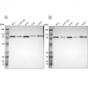 Anti-STAT1 antibody produced in rabbit 