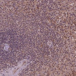 Anti-STAT3 antibody produced in rabbit HPA058603-100UL