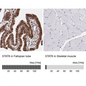 Anti-STAT6 antibody produced in rabbit 