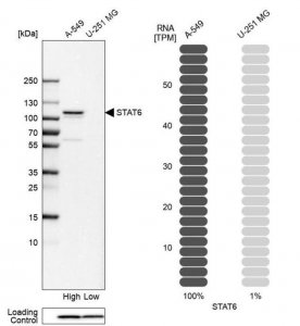 Anti-STAT6 antibody produced in rabbit 