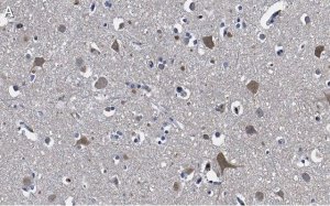 Anti-Stathmin-2 Antibody, clone 1B3 ZooMAb� Rabbit Monoclonal 
