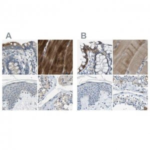 Anti-STBD1 antibody produced in rabbit 