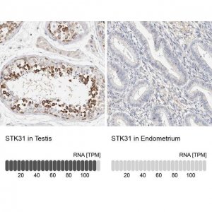 Anti-STK31 antibody produced in rabbit 