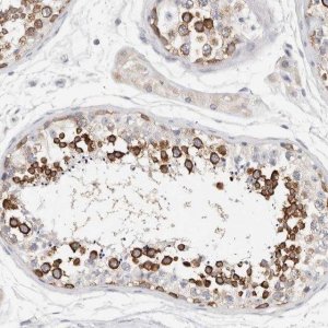Anti-STK31 antibody produced in rabbit 