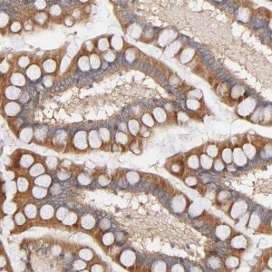 Anti-STRN3 antibody produced in rabbit HPA003392-100UL