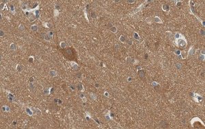 Anti-Substance P Antibody, clone 1K3 ZooMAb� Rabbit Monoclonal 