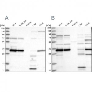 Anti-SUCLG1 antibody produced in rabbit 
