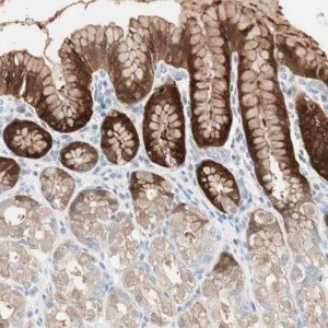 Anti-SULT1C2 antibody produced in rabbit HPA007190-100UL