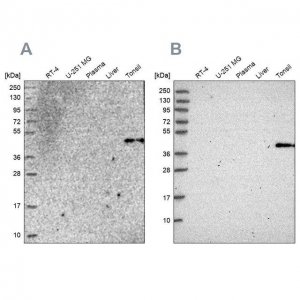 Anti-SULT2B1 antibody produced in rabbit 