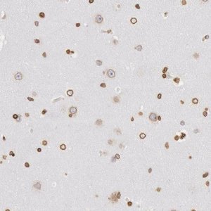 ANTI-SUN2 antibody produced in rabbit 
