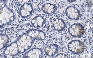 Anti-SUPV3L1 Antibody, clone 2F5 ZooMAb� Rabbit Monoclonal 