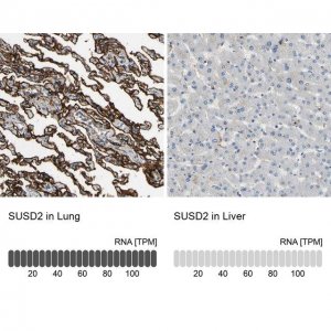Anti-SUSD2 antibody produced in rabbit 