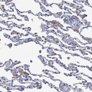 Anti-SVEP1 antibody produced in rabbit 