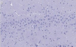 Anti-Synaptophysin Antibody, clone 2B21, ZooMAb� Rabbit Monoclonal 