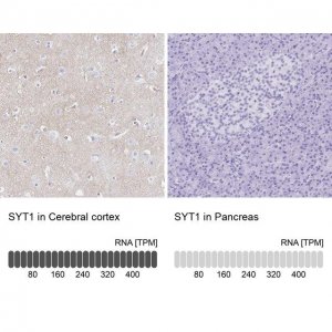 Anti-SYT1 antibody produced in rabbit 