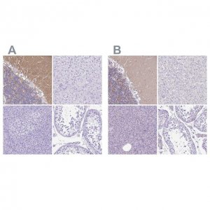 Anti-SYT1 antibody produced in rabbit 