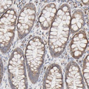 Anti-SYT16 antibody produced in rabbit HPA004199-100UL