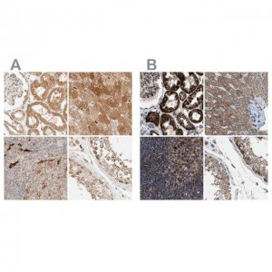 Anti-TACO1 antibody produced in rabbit HPA024294-100UL