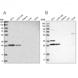 Anti-TACO1 antibody produced in rabbit HPA024294-100UL