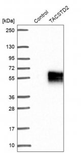 Anti-TACSTD2 antibody produced in rabbit 