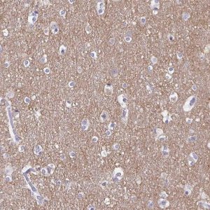 Anti-TAGLN3 antibody produced in rabbit 