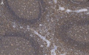 Anti-Talin-1 Antibody, clone 2F8 ZooMAb� Rabbit Monoclonal 