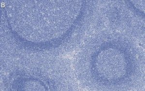 Anti-Talin-1 Antibody, clone 2F8 ZooMAb� Rabbit Monoclonal 