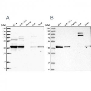 Anti-TBCC antibody produced in rabbit 
