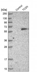 Anti-TC2N antibody produced in rabbit HPA027549-100UL