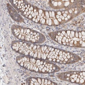 Anti-TC2N antibody produced in rabbit HPA027549-100UL