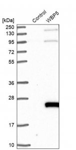 Anti-TCEAL9 antibody produced in rabbit 