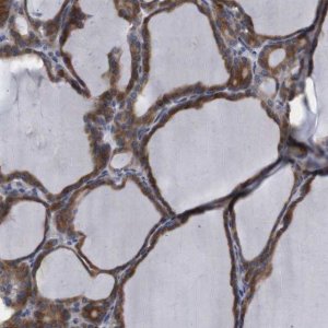 Anti-TCEAL9 antibody produced in rabbit 