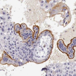 Anti-TCEANC antibody produced in rabbit 