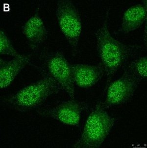 Anti-TCF-4 Antibody, clone 1G4 ZooMAb� Rabbit Monoclonal 