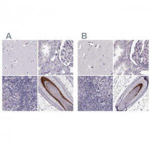 Anti-TCHHL1 antibody produced in rabbit 