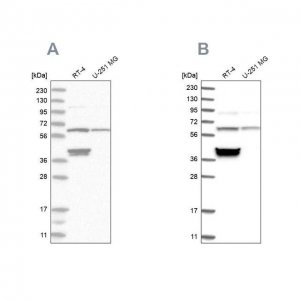 Anti-TCP1 antibody produced in rabbit 