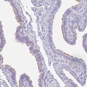 Anti-TCTEX1D4 antibody produced in rabbit 