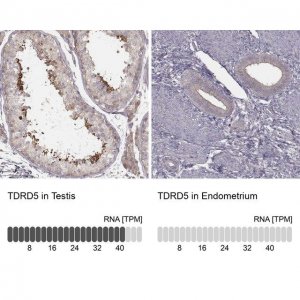 Anti-TDRD5 antibody produced in rabbit 