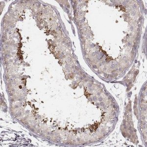 Anti-TDRD5 antibody produced in rabbit 