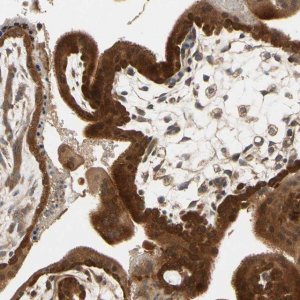 Anti-TDRP antibody produced in rabbit HPA008462-100UL