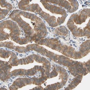Anti-TDRP antibody produced in rabbit HPA008462-100UL