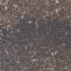 Anti-TEC antibody produced in rabbit 
