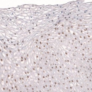 Anti-TET3 antibody produced in rabbit 
