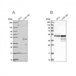 Anti-TFAP2A antibody produced in rabbit 