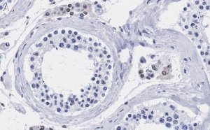 Anti-TFE3 Antibody, clone 1G5 ZooMAb� Rabbit Monoclonal 