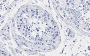 Anti-TFE3 Antibody, clone 1G5 ZooMAb� Rabbit Monoclonal 