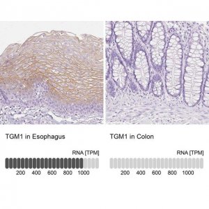 Anti-TGM1 antibody produced in rabbit 