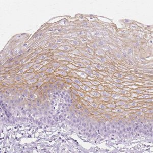 Anti-TGM1 antibody produced in rabbit 
