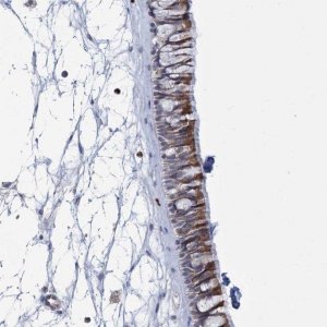 Anti-THAP6 antibody produced in rabbit 